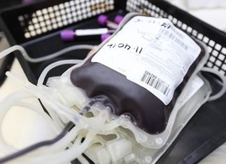 Condena por los daños derivados de una transfusión de sangre condena transfusion sangre