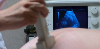 Fallo de la Corte Suprema liberó de responsabilidad a una clínica por mala praxis médica fallo corte suprema responsabilidad clínica mala praxis médica