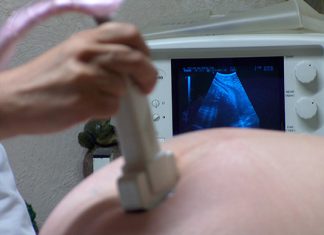 Fallo de la Corte Suprema liberó de responsabilidad a una clínica por mala praxis médica fallo corte suprema responsabilidad clínica mala praxis médica